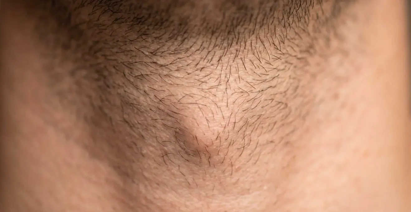 Vista macro del collo maschile che mostra le diverse direzioni di crescita del pelo